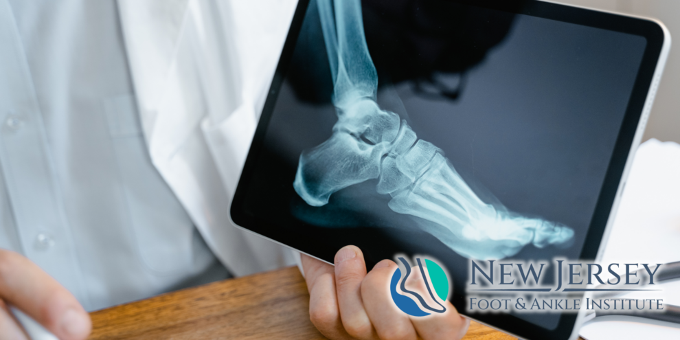 How Arthritis Affects Your Feet Symptoms, Causes & Treatment