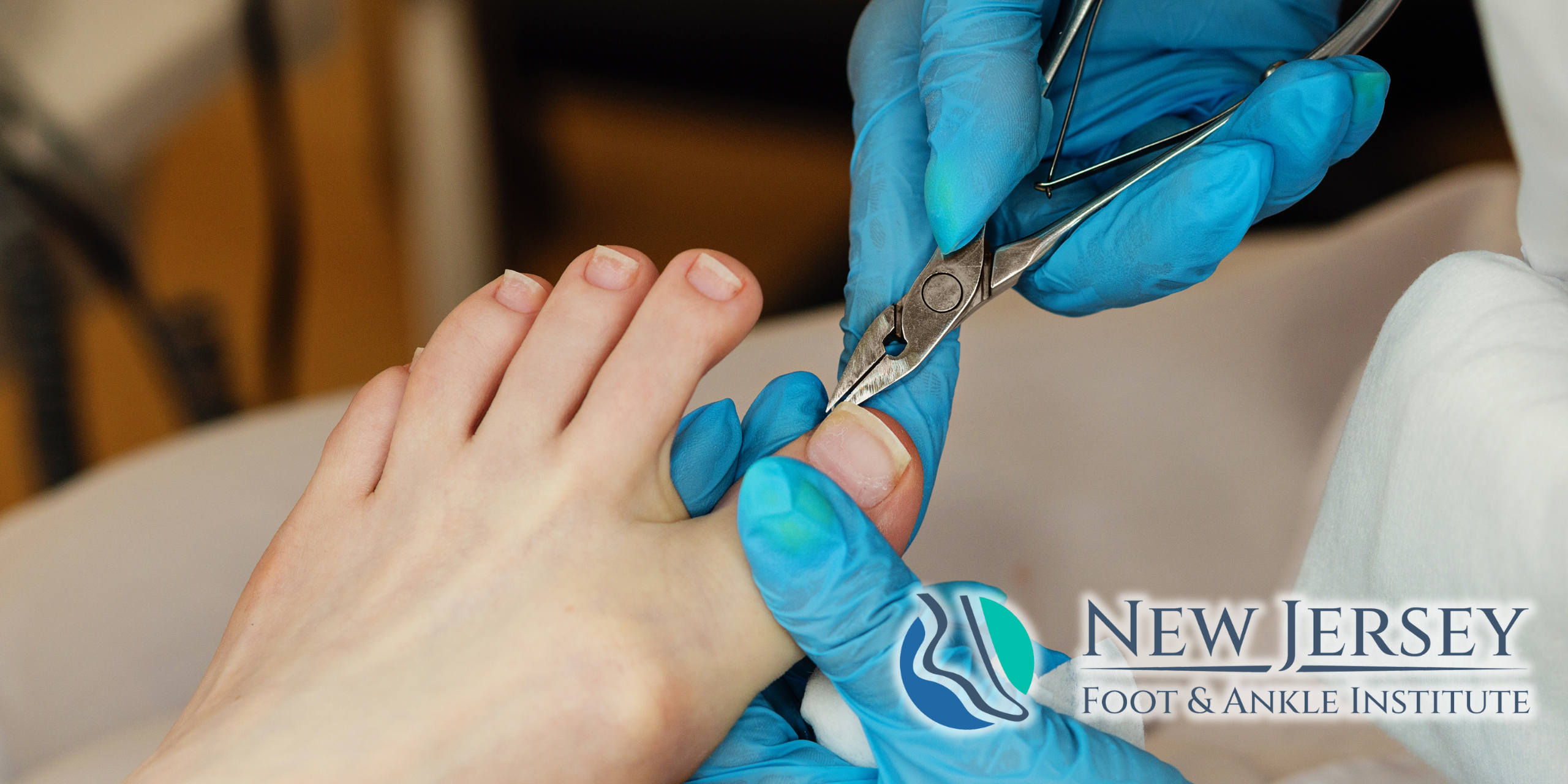 Ingrown Toenails Causes, Treatment & When to See a Podiatrist