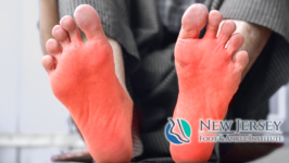 What Causes Burning or Tingling Feet- NJFAI