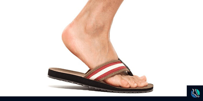 flip-flops-pain-min Foot Pain from sandals and flip flops