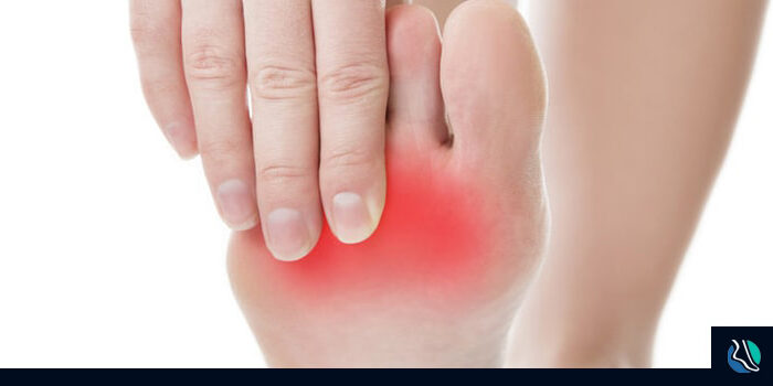 mortons-neuroma-doctor-nj-min Mortons Neuroma - Podiatrist NJ