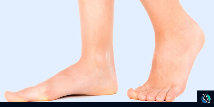 treating-flat-feet-or-not Treating Pediatric Flat Foot