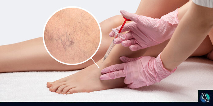 vein-ftd-img Vein specialist