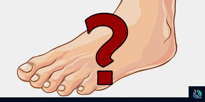 warts-callus-ftd-img-min2 What the Difference between Warts and Calluses?