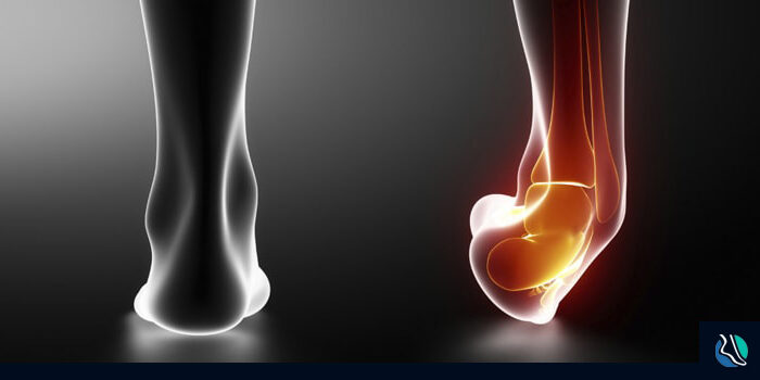 weak-ankles-ftd-min why do i have weak ankles?